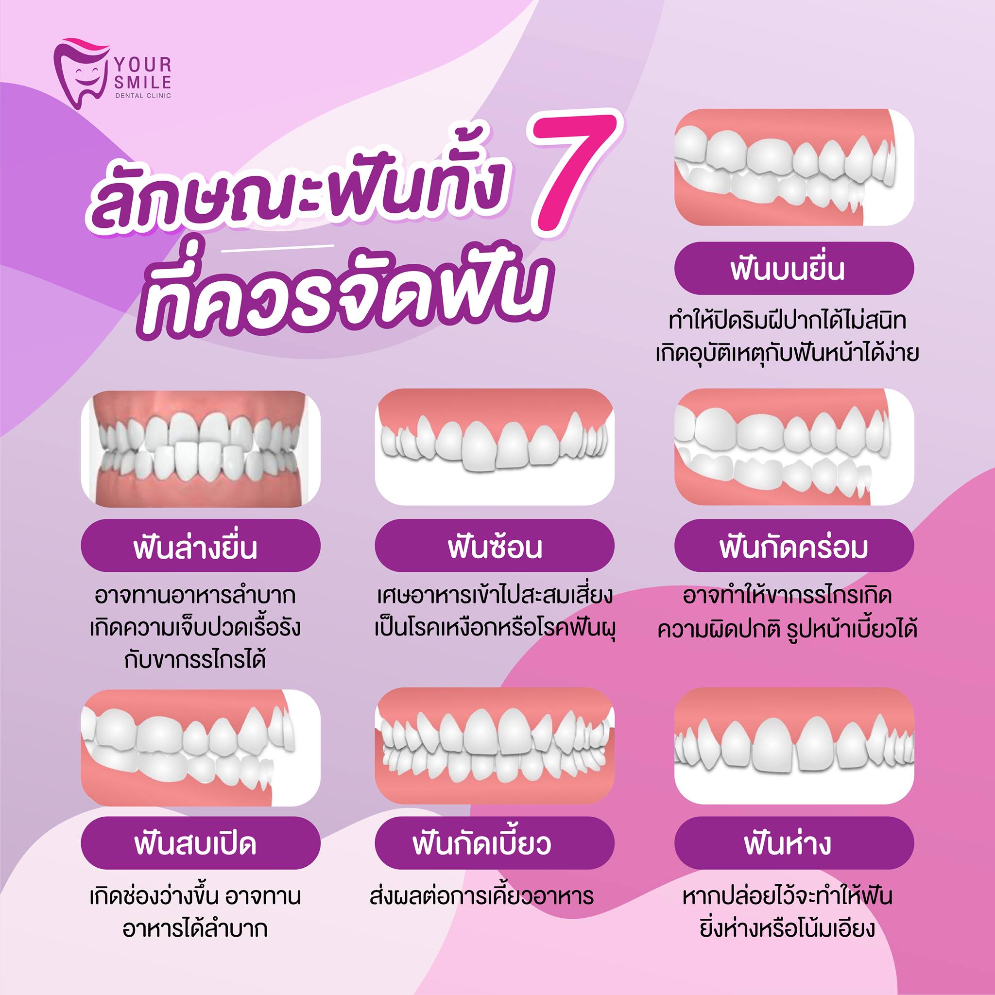 7 ลักษณะฟันที่ควรปรึกษาทันตแพทย์
