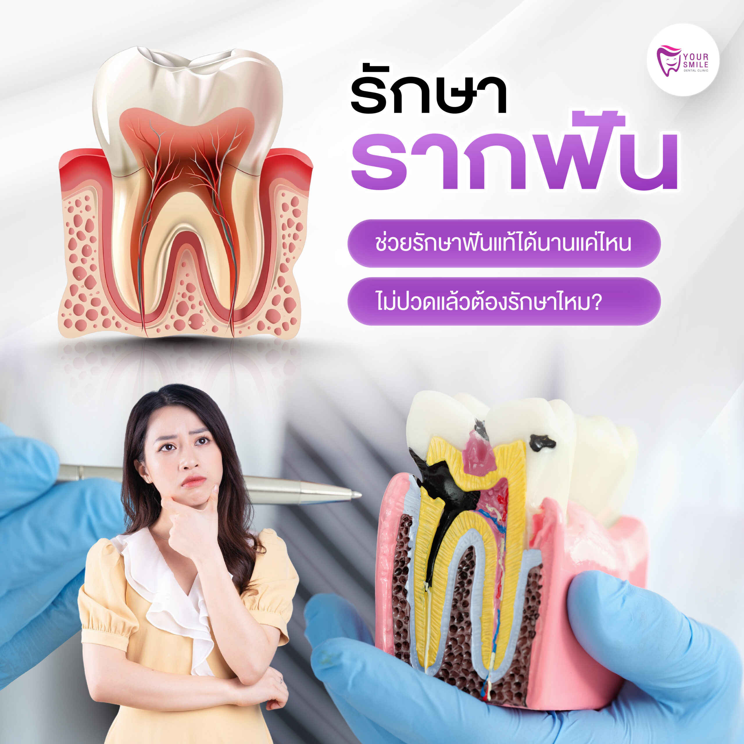 รักษารากฟัน