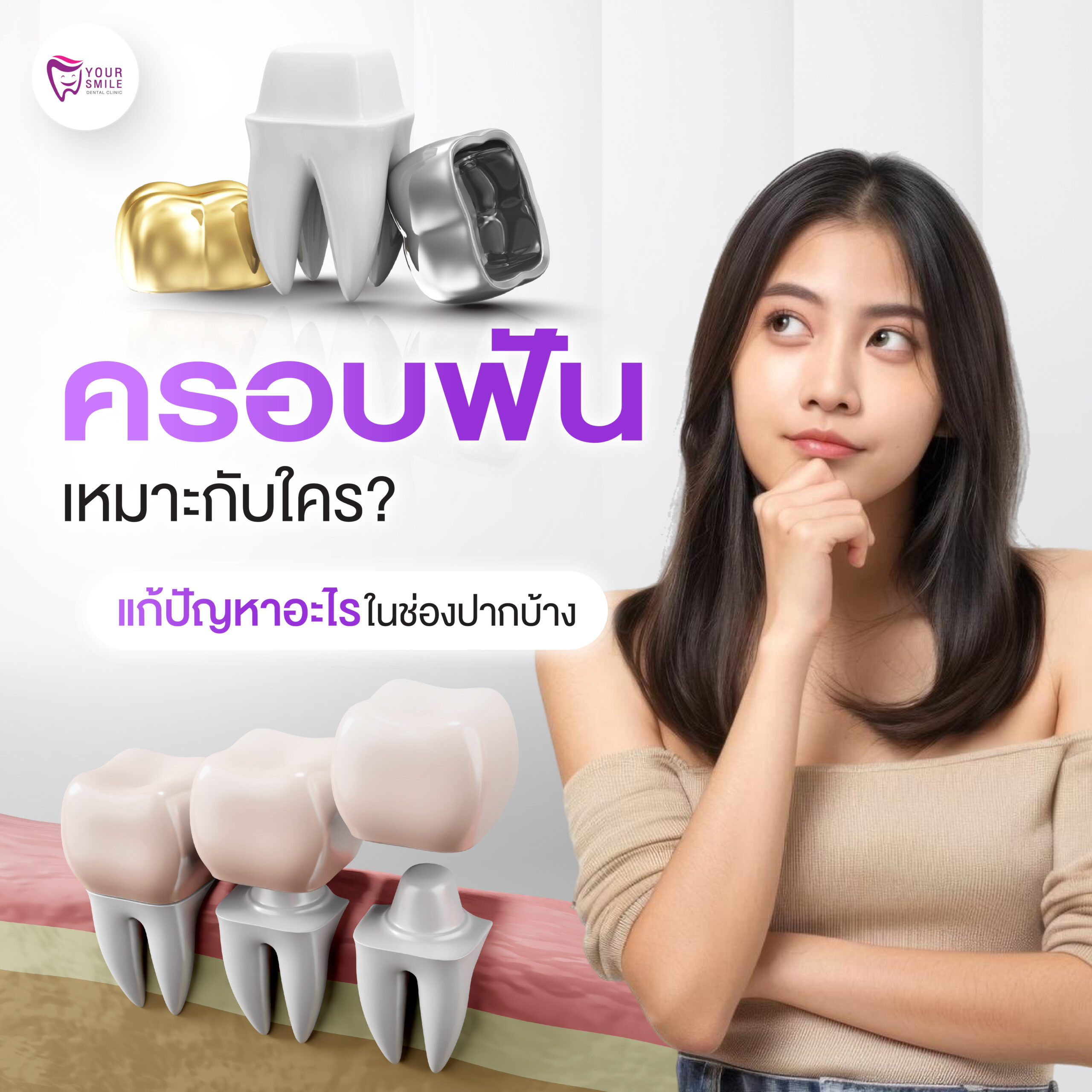 ครอบฟัน เหมาะกับใคร