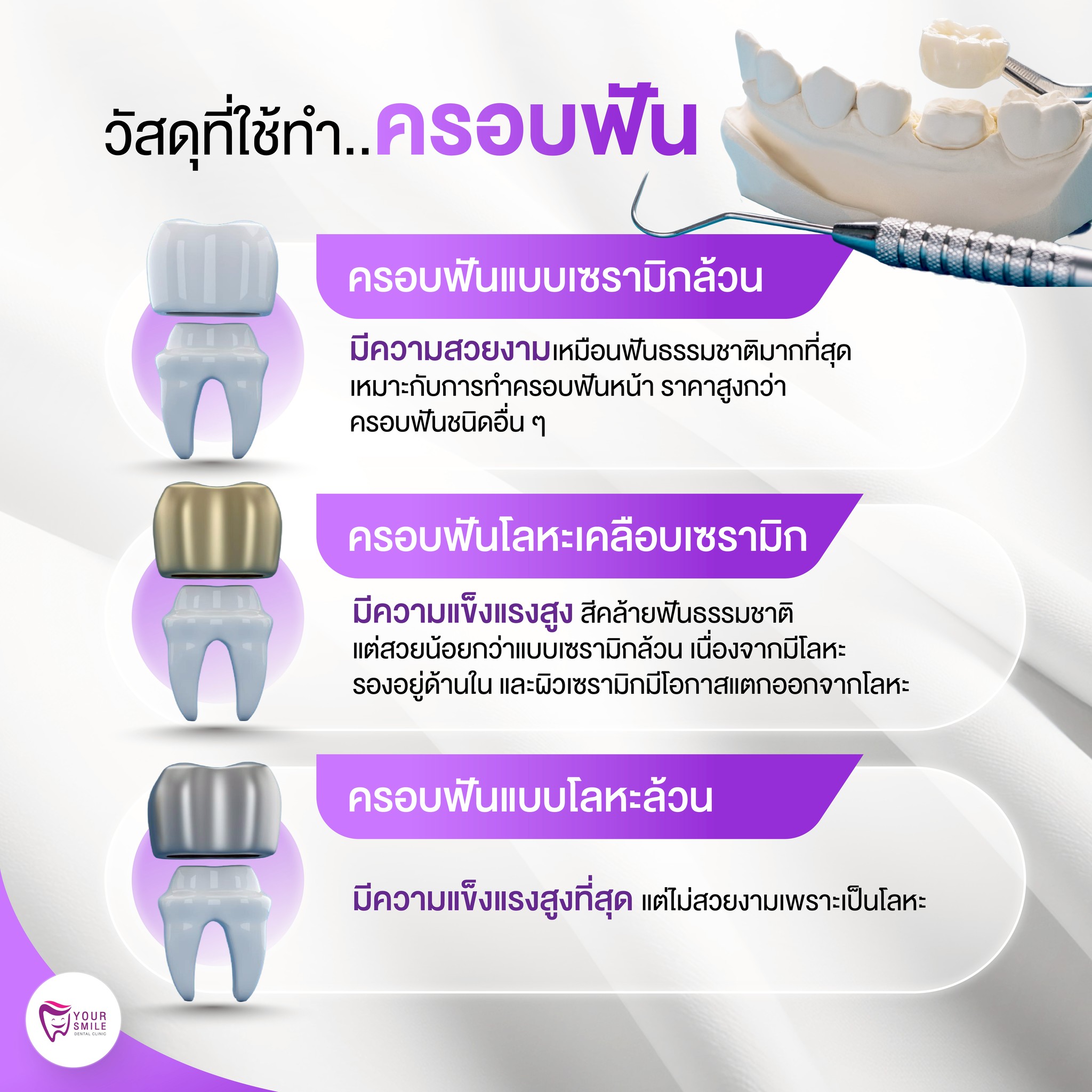 วัสดุที่ใช้ครอบฟัน