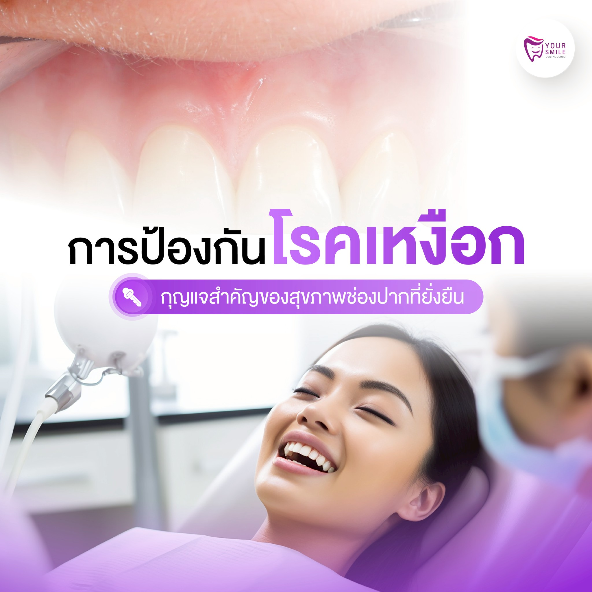 การป้องกันโรคเหงือก