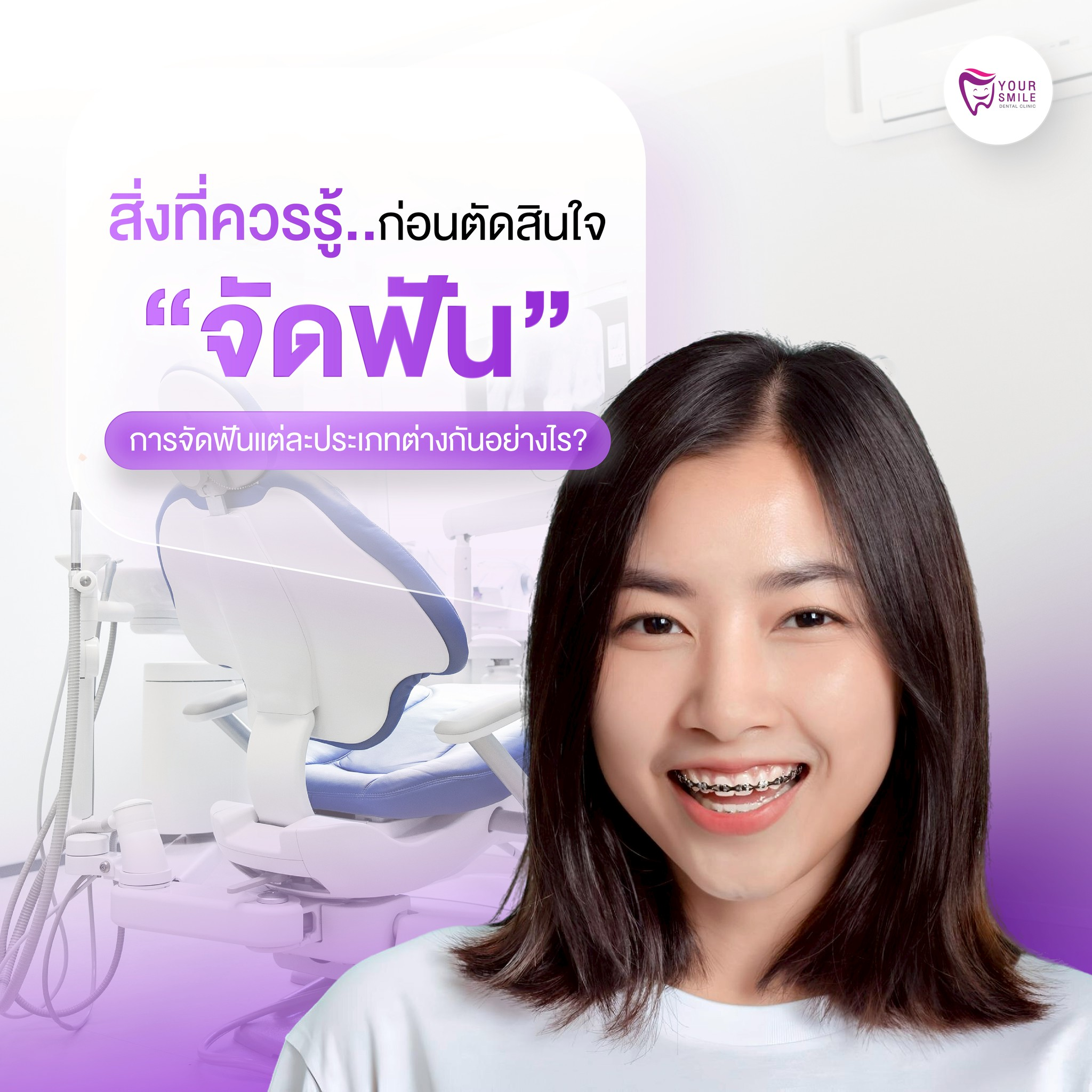 การจัดฟันแต่ละประเภท