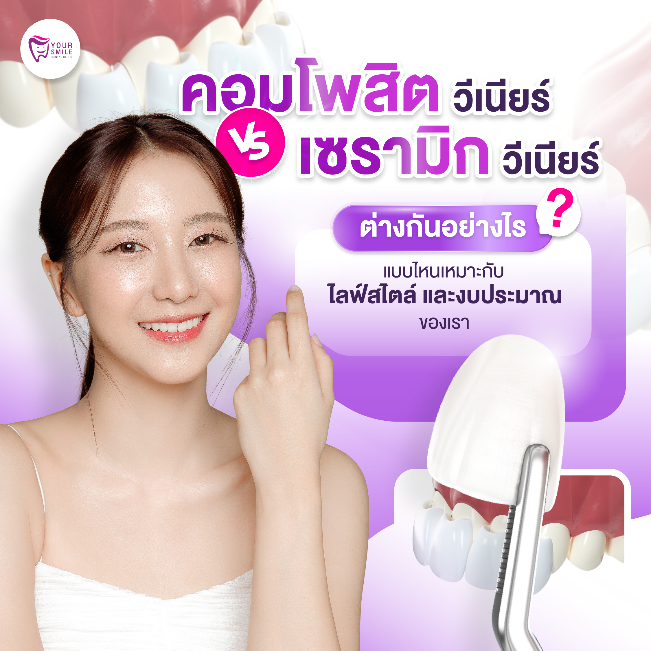 เซรามิกวีเนียร์