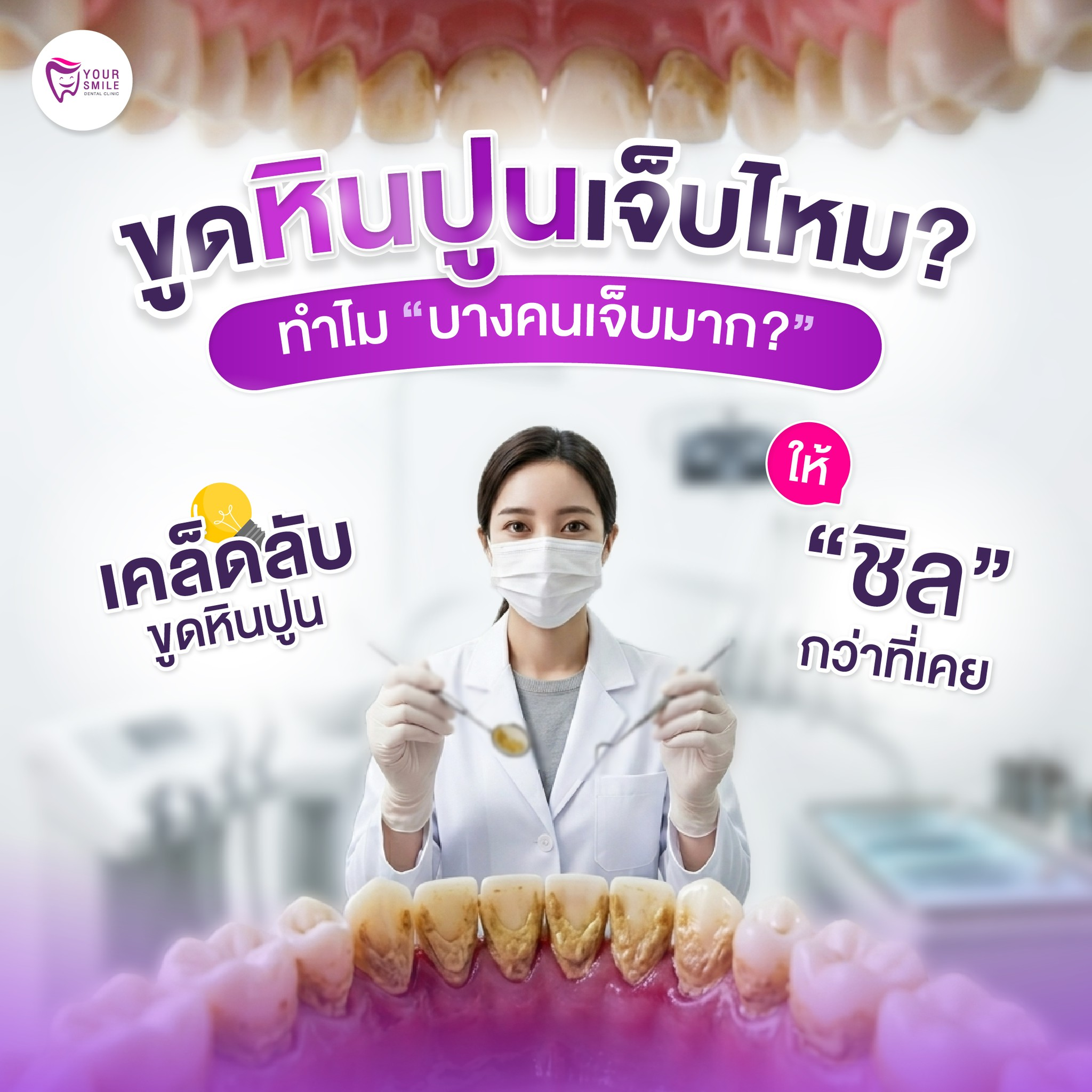 ขูดหินปูน เจ็บไหม