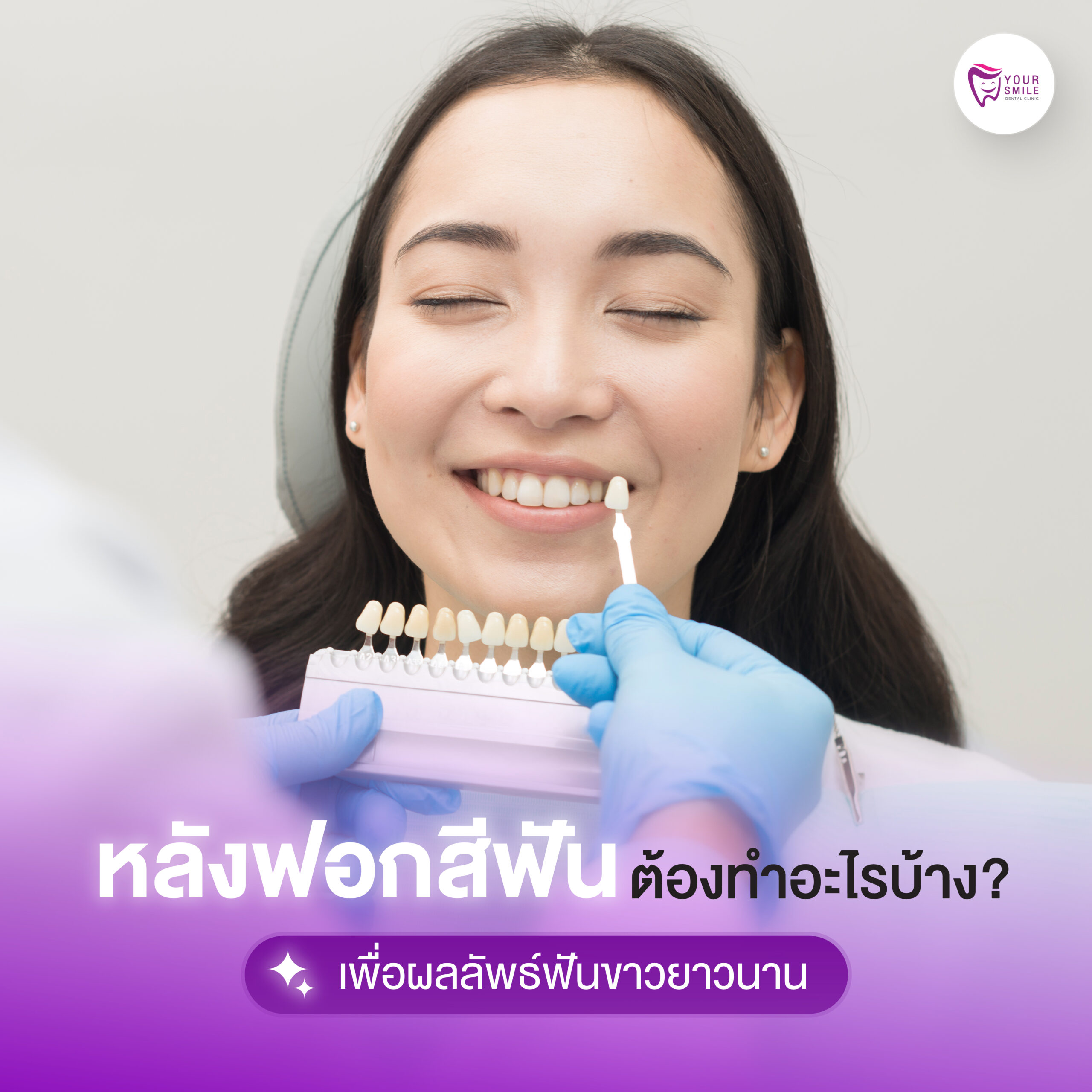 หลังฟอกสีฟัน