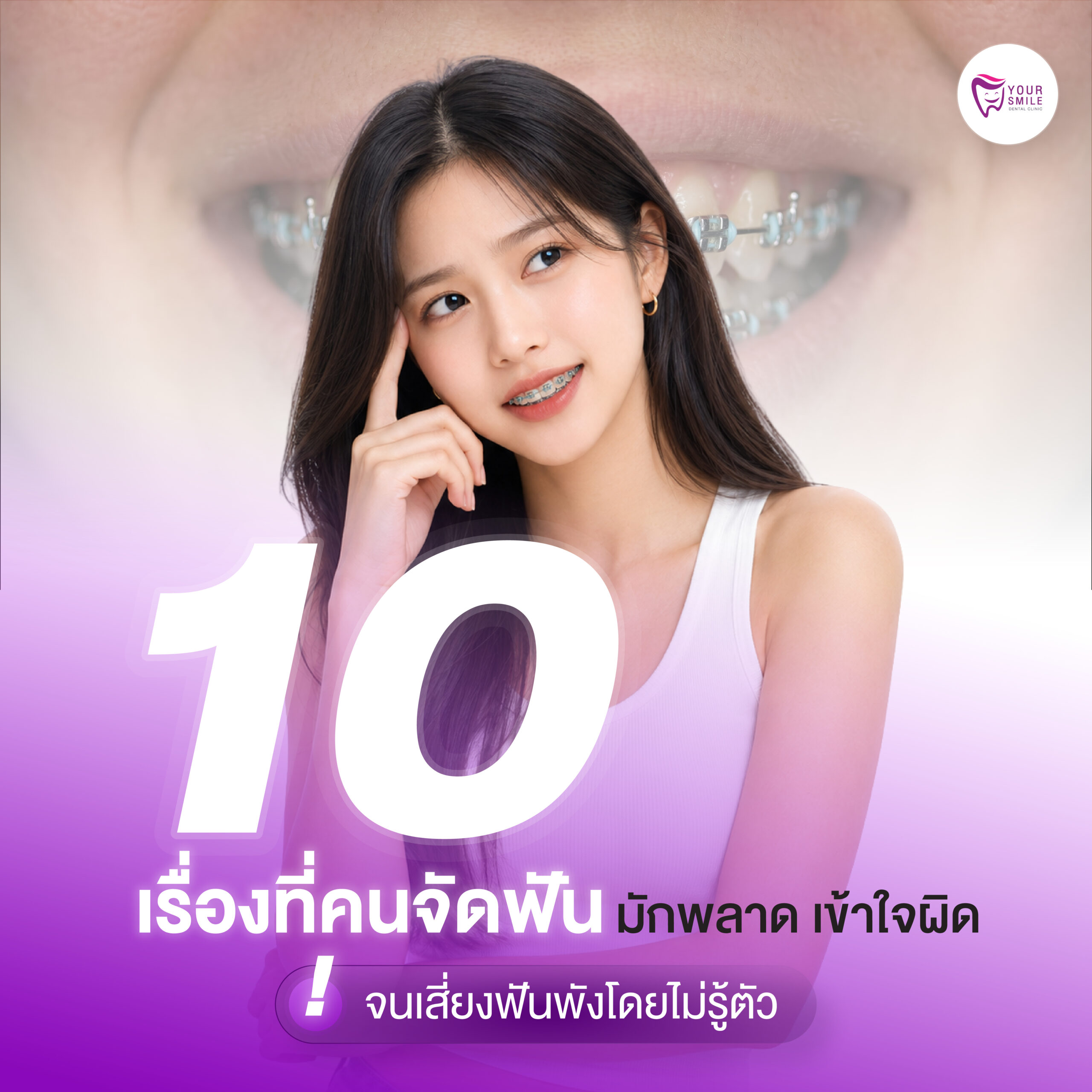 เรื่องที่คนจัดฟันมักพลาด